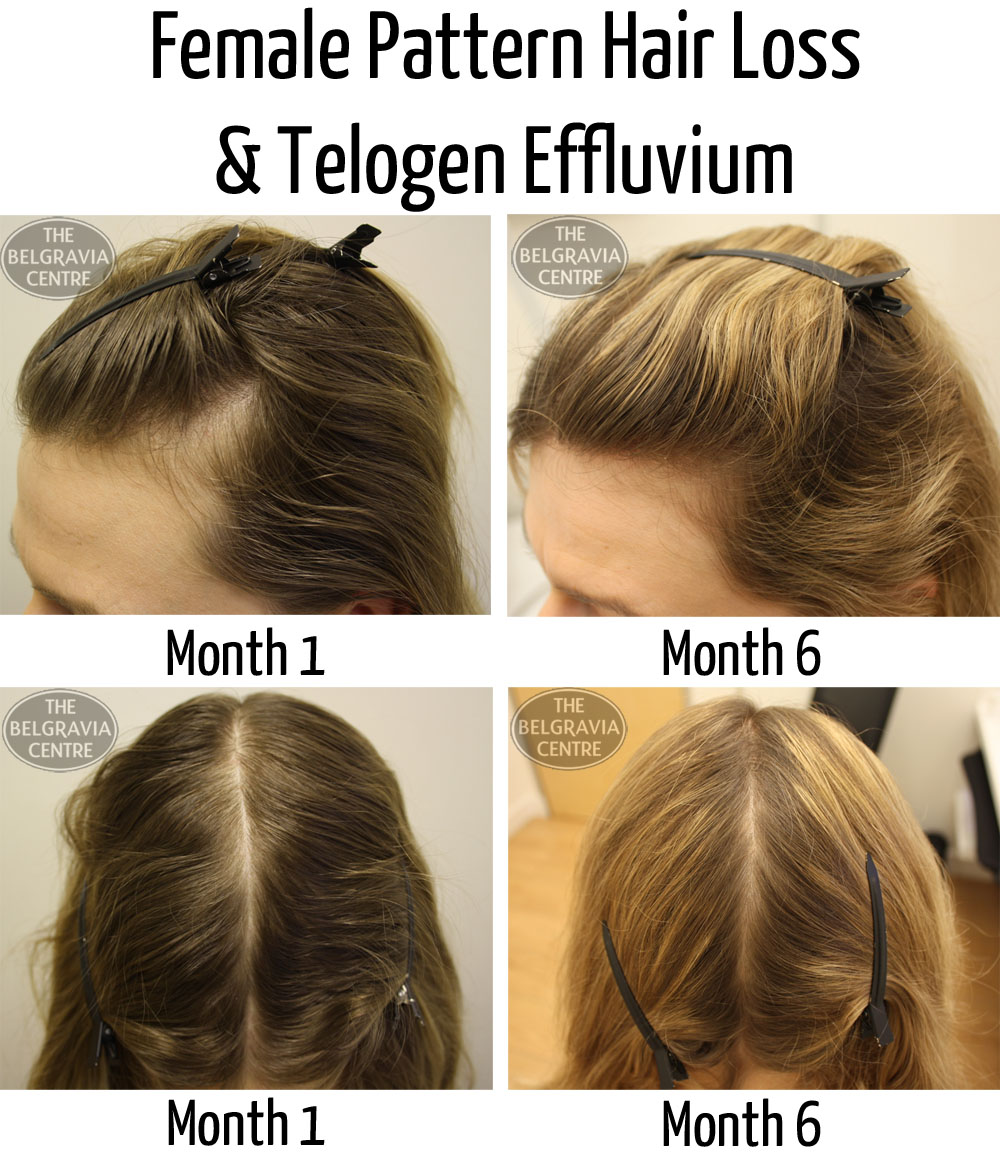 Trileptal reviews for bipolar work